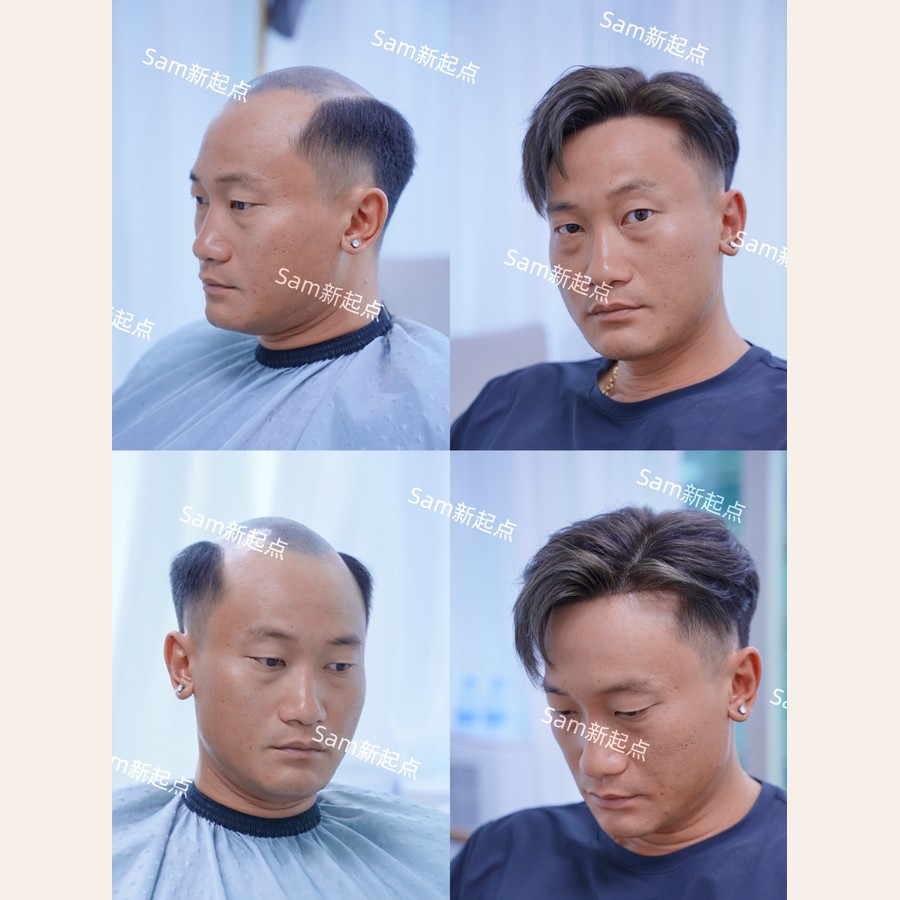 地中海男士假髮四宮格案例