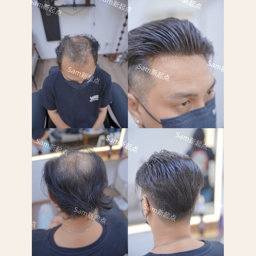 男士假髮案例一