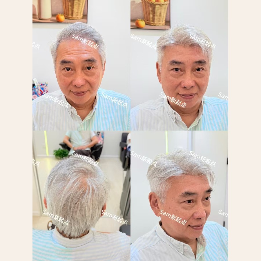 男士假髮案例二