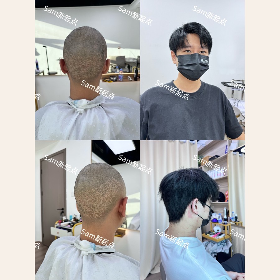 男士假髮案例三